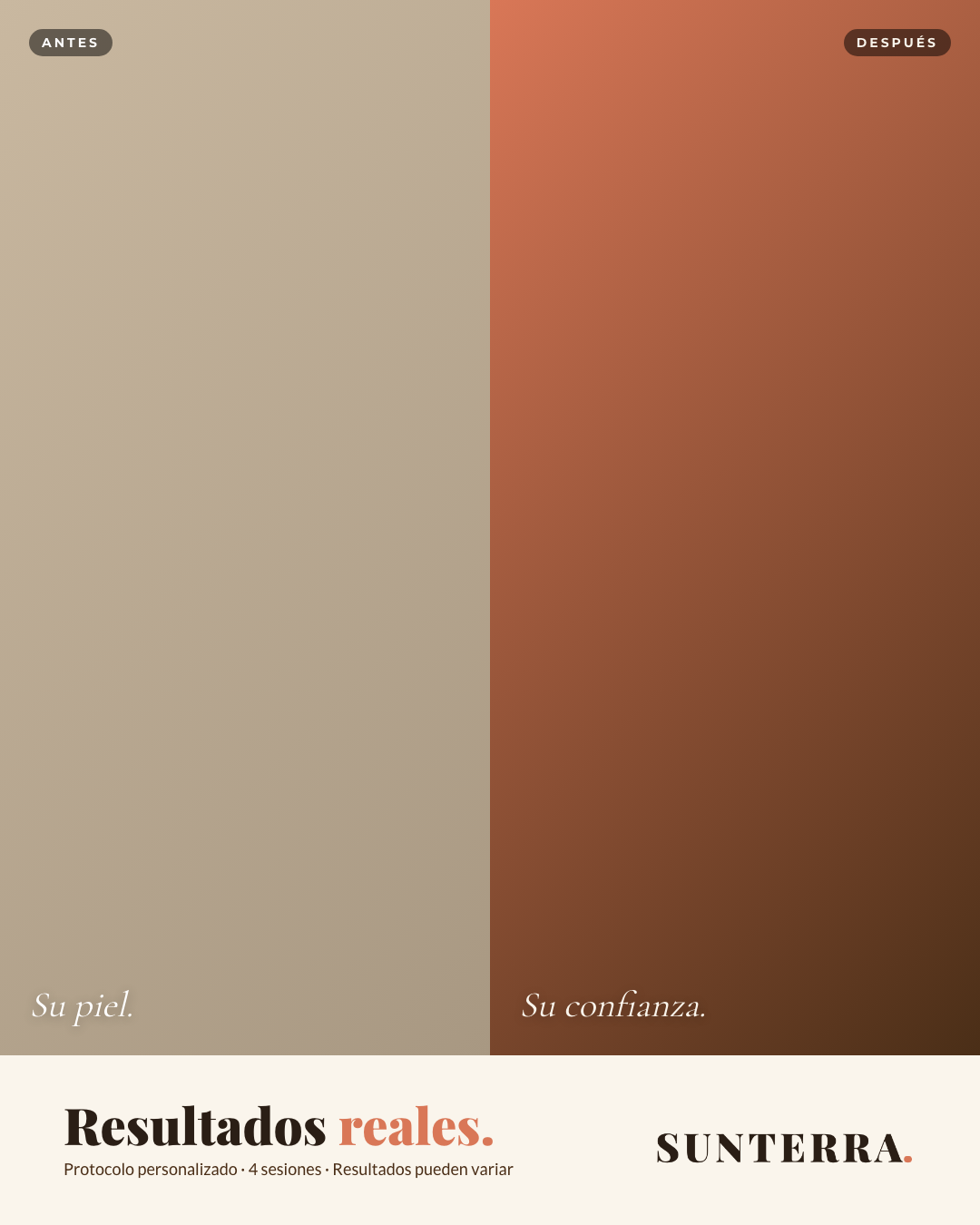 Post antes y después Sunterra